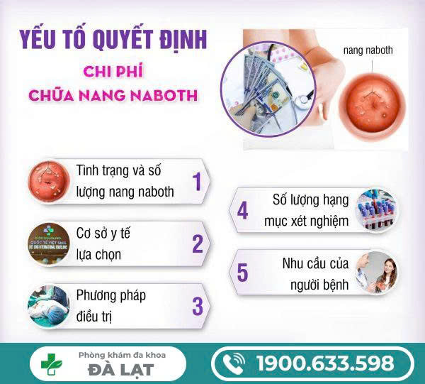 Hình ảnh minh họa